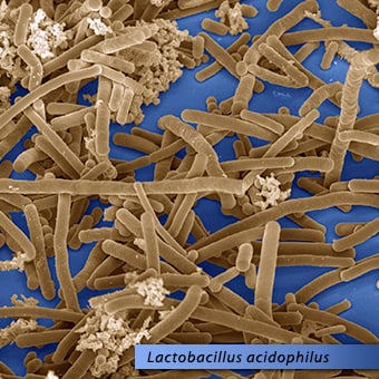 SEM micrograph of Lactobacillus acidophilus within casein micelles and lipid spheres in yogurt